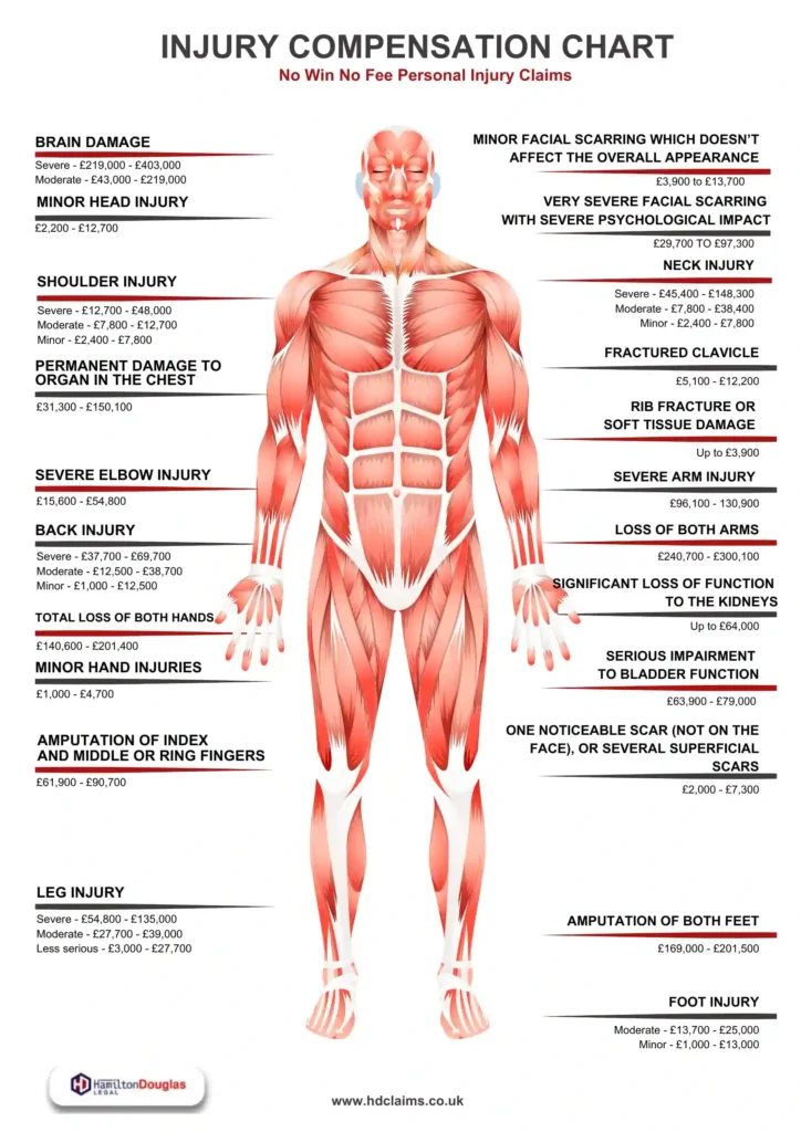 INJURY COMPENSATION CHART